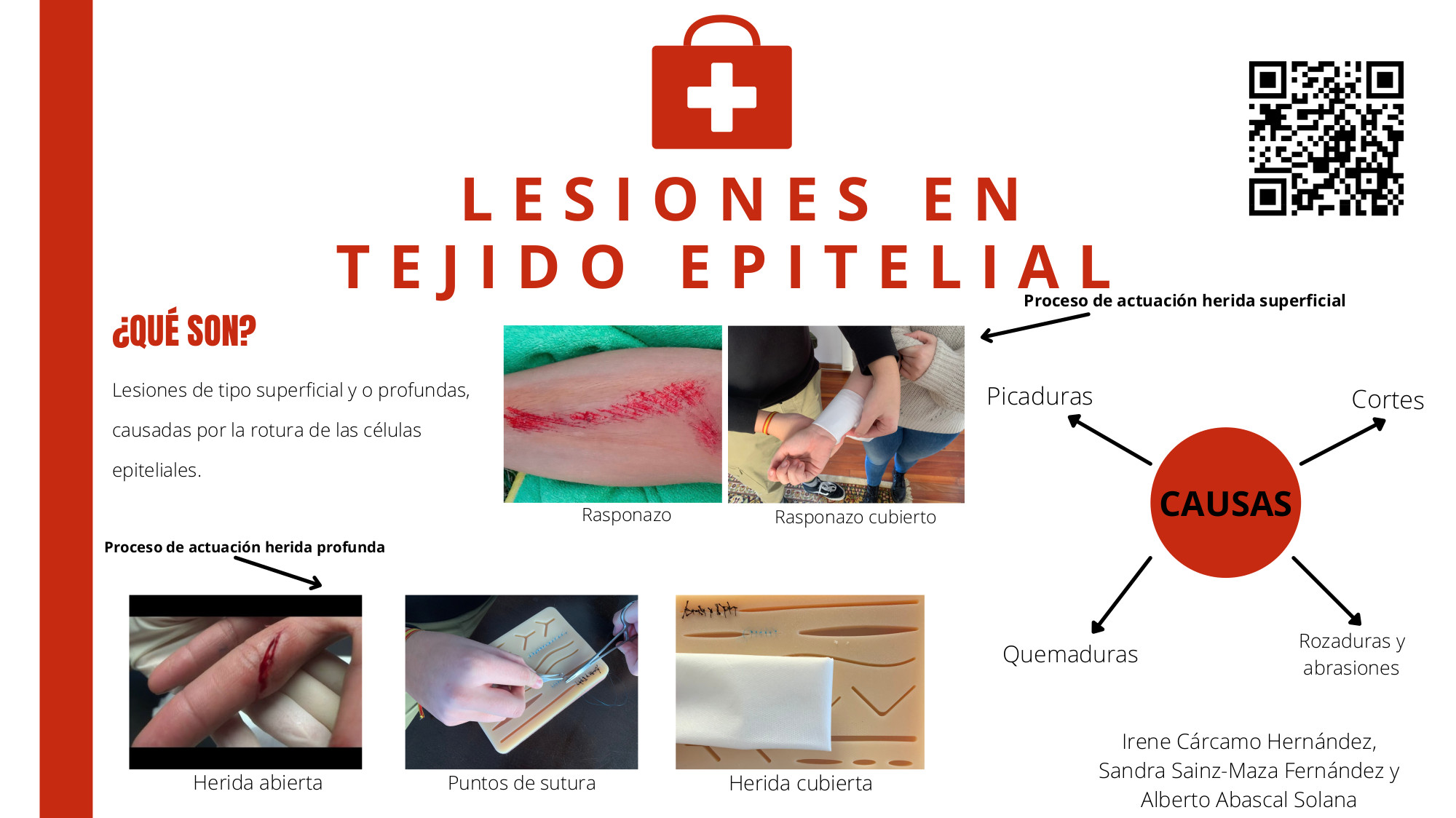 Infografía Lesiones en tejido epitelial